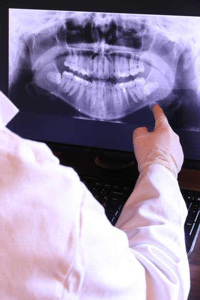 Best Emergency Tooth Extraction in Mansfield, TX